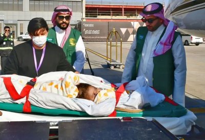 وصول التوأم السيامي الإرتيري "أسماء وسمية" إلى الرياض