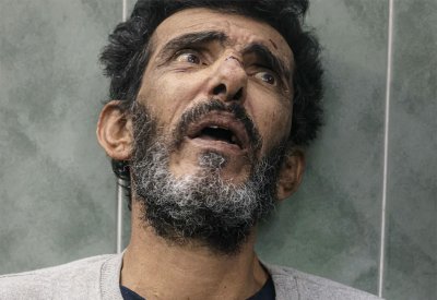 100 يوم لحرب لا مثيل لها في الشرق الأوسط.. صور ترصد المعاناة