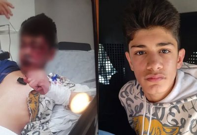 دخل في غيبوبة بسبب لعبة بتركيا.. طفل سوريا لا يرى ولا يتكلم!