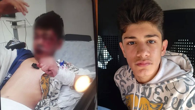 دخل في غيبوبة بسبب لعبة بتركيا.. طفل سوريا لا يرى ولا يتكلم!