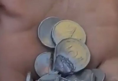 بالفيديو: من غزة.. عملة معدنية تنقذ شابًا من موت محتم