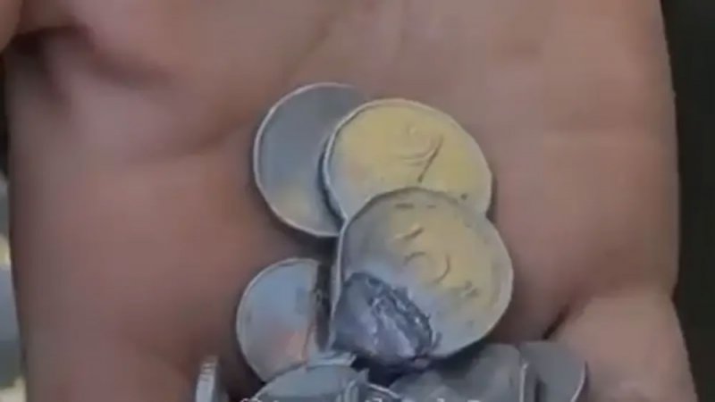 بالفيديو: من غزة.. عملة معدنية تنقذ شابًا من موت محتم