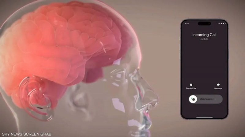 نيورالينك تستعد لتجريب زراعة شريحة جديدة في الدماغ