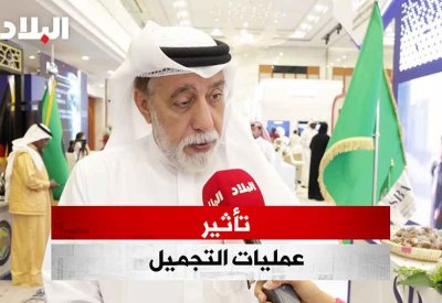 بالفيديو: أحمد الجسمي: فنانات أصبحن بفضل كثرة عمليات التجميل لا يصلحن لتقديم أعمال تراثية