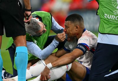 الاتحاد الفرنسي: مبابي يعاني من كسر في أنفه وسيرتدي قناعا