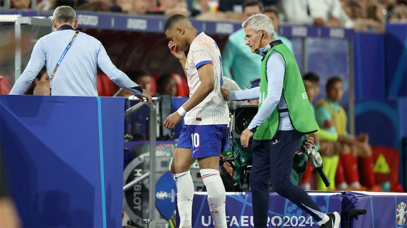 بعد إصابته.. "تلميح" من مبابي بشأن فرص مشاركته في يورو 2024