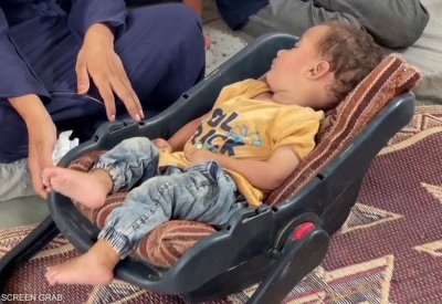 هدنة "شلل الأطفال" في غزة.. الصحة العالمية تعلن التفاصيل