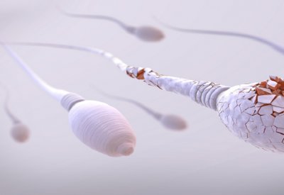كيف تؤثر عيوب الحيوانات المنوية لدى الأب على صحة الأم والطفل؟