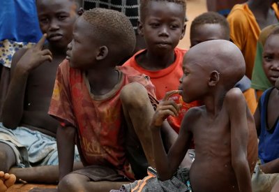 السودان.. سوء التغذية يفتك بأرواح الأطفال