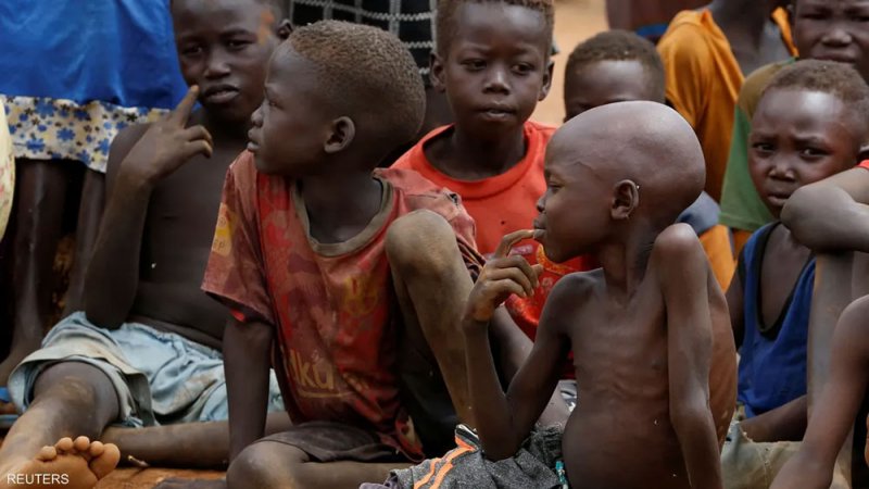 السودان.. سوء التغذية يفتك بأرواح الأطفال