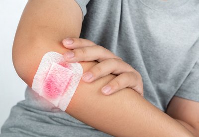 ابتكار طابعة حيوية لعلاج الجروح غير القابلة للشفاء