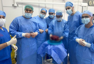 فريق طبي يستأصل ورمًا كبيرًا ومعقدًا من كلية مريض خمسيني