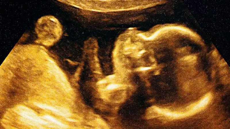 الأجنة تتحكم في الأمهات بواسطة "الريموت كونترول"