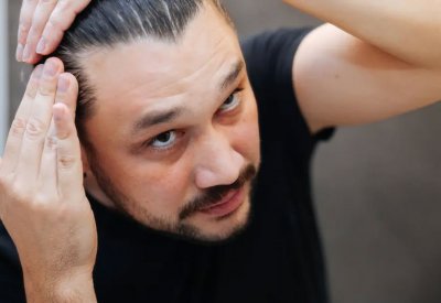 عصير البصل.. وصفة طبيعية قد تعيد نمو الشعر في المناطق الصلعاء