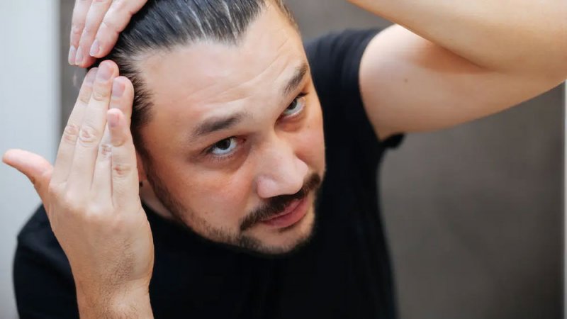 عصير البصل.. وصفة طبيعية قد تعيد نمو الشعر في المناطق الصلعاء