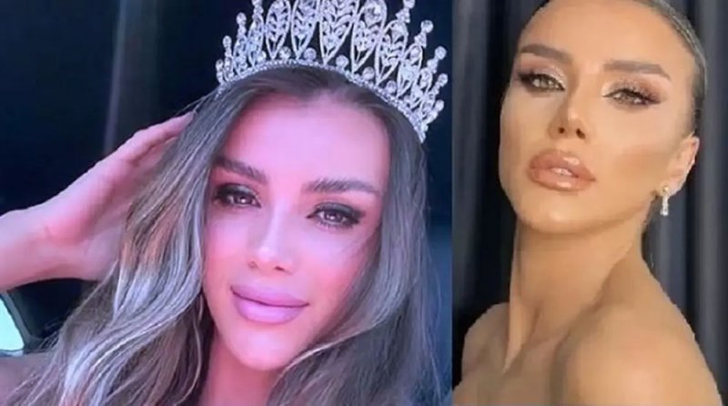 مصرع ملكة جمال دهسًا بعد فرارها من الشرطة