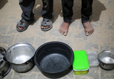 وفاة 57 طفلا في غزة بسبب سوء التغذية