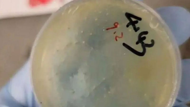 تهريب مواد بيولوجية وديدان.. اعتقال عالمة صينية في أميركا