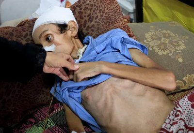 غوتيريش: الوضع في غزة "فيلم رعب".. والمجاعة تدق كل باب