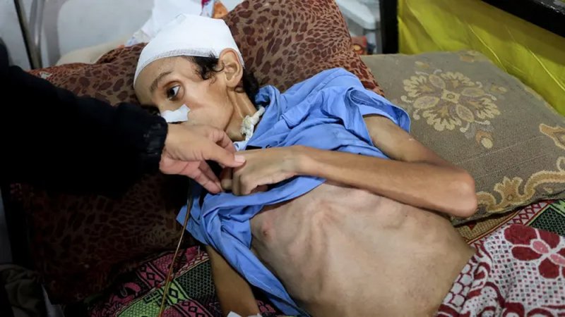 غوتيريش: الوضع في غزة "فيلم رعب".. والمجاعة تدق كل باب