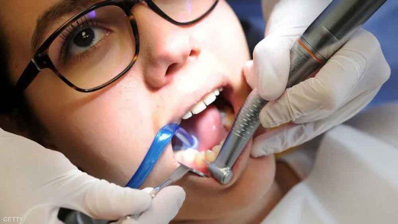 لون أسنانك يتحدث عن صحتك.. إليك ما يقول