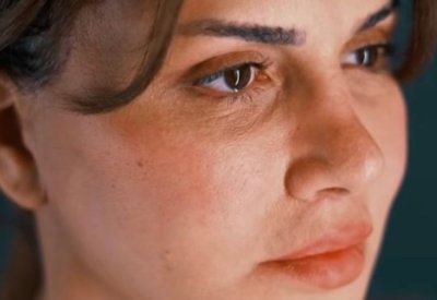 آخرهن نجلاء بدر.. نجمات شوهتهن عمليات التجميل الفاشلة