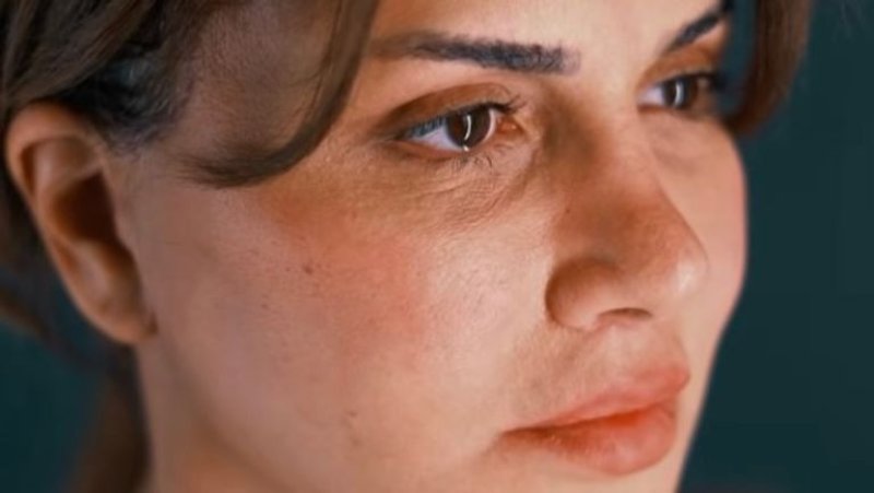 آخرهن نجلاء بدر.. نجمات شوهتهن عمليات التجميل الفاشلة