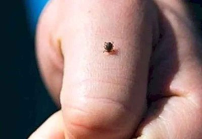 42 وفاة بالحمى النزفية في العراق منذ مطلع العام