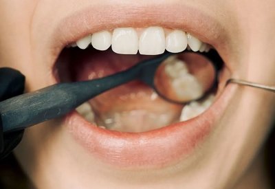 أنفاس الصباح.. رائحة الفم الكريهة تفضح شيئا لا تعرفه