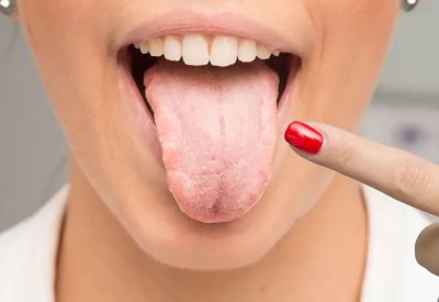 لسانك مرآة جسمك.. كيف تكشف الطبقة واللون مشاكل الجهاز الهضمي؟