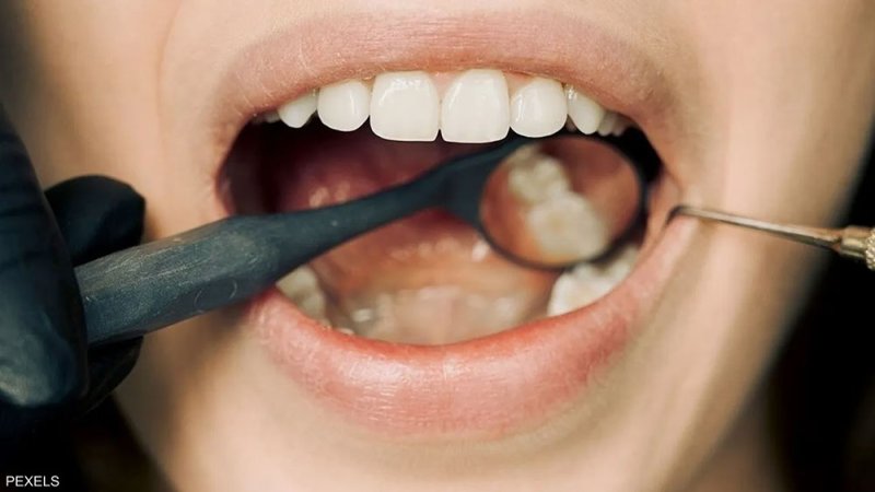 أنفاس الصباح.. رائحة الفم الكريهة تفضح شيئا لا تعرفه