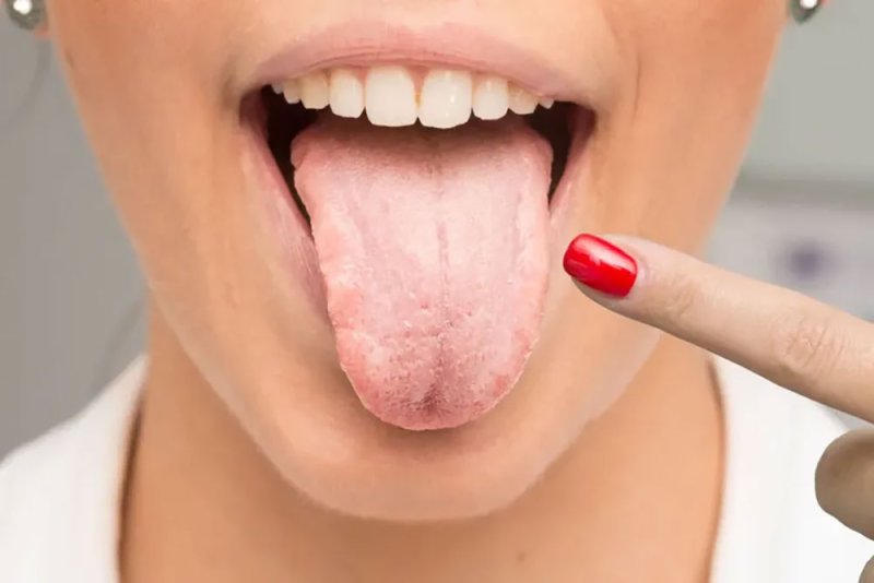 لسانك مرآة جسمك.. كيف تكشف الطبقة واللون مشاكل الجهاز الهضمي؟