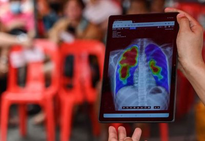 منظمة الصحة العالمية: السل يواصل تصدر قائمة الأمراض الأكثر فتكًا في العالم
