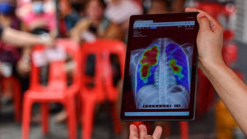 منظمة الصحة العالمية: السل يواصل تصدر قائمة الأمراض الأكثر فتكًا في العالم