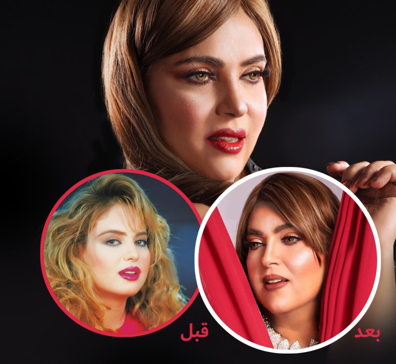 وفاء مكي قبل وبعد: "ليست جراحة تجميل"!