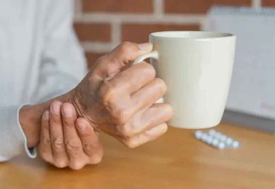 دراسة: بكتيريا تسوس الأسنان قد تلعب دورًا في تطور باركنسون