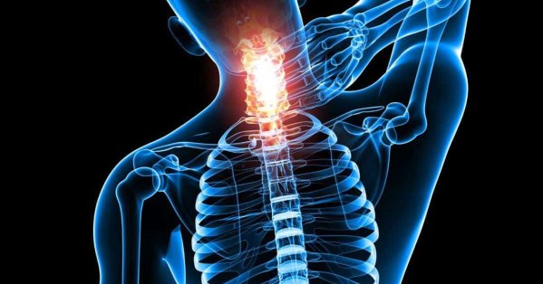 الأطباء يحذّرون: "قرطعة” الرقبة قد تؤدي إلى سكتة دماغية 