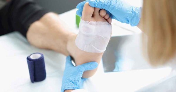 Smart Wound Dressing Treats Diabetic Ulcers Without Human Cells – Al-Bilad Newspaper