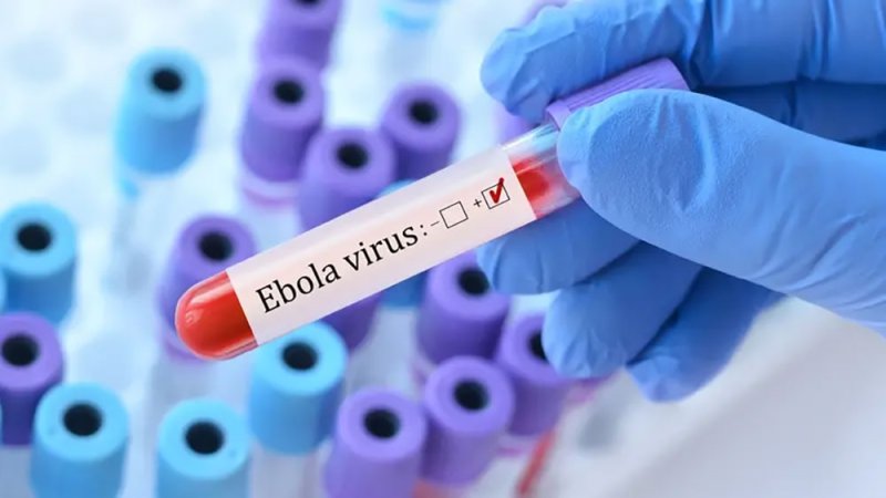 الصحة العالمية: خطر تفشي إيبولا مرتفع على المستوى الإقليمي ومنخفض عالمياً