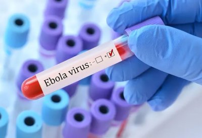 5 متعافين من إيبولا يمنحون الأمل لشرق الكونغو