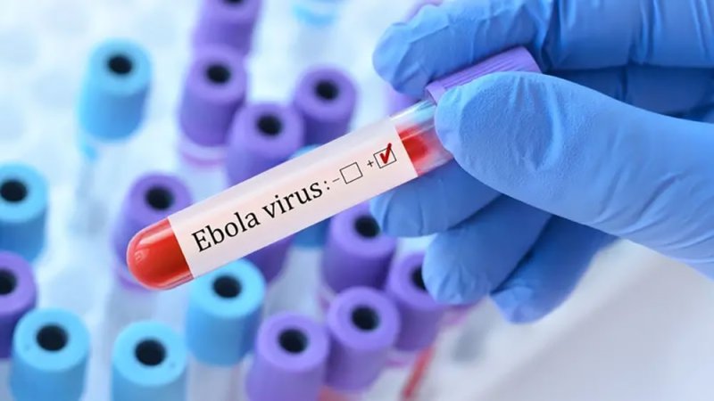 5 متعافين من إيبولا يمنحون الأمل لشرق الكونغو