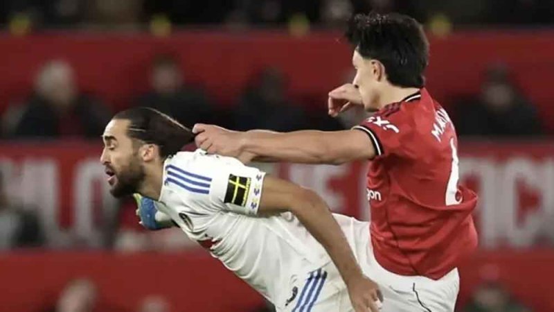 الدوري الإنجليزي يعدل قانون شد الشعر