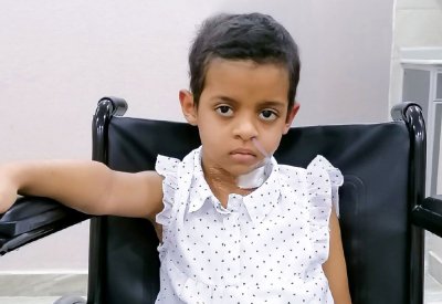 “حمد الجامعي” ينجح في استئصال ورم كبير من مخ طفلة