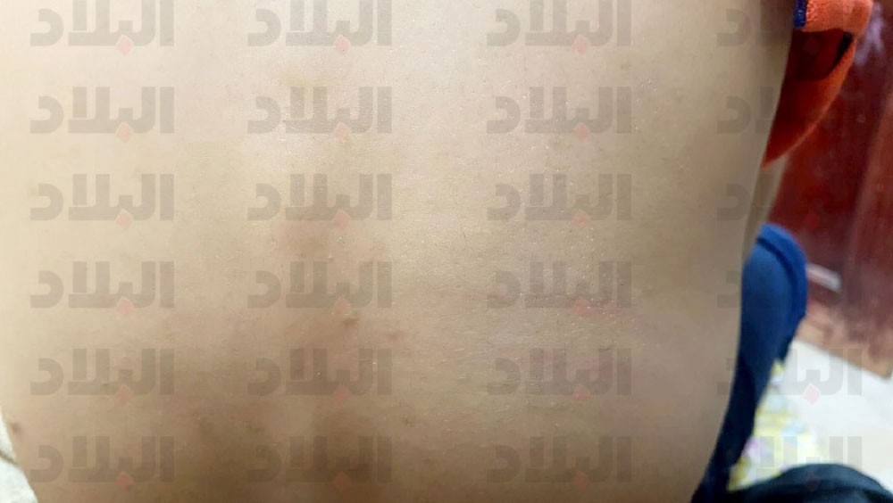 معلم يضرب بـ “العقال” طالبًا بمدرسة الخميس
