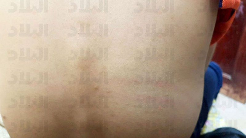 إحالة “المعلم ضارب الطالب بالعقال” للتحقيق
