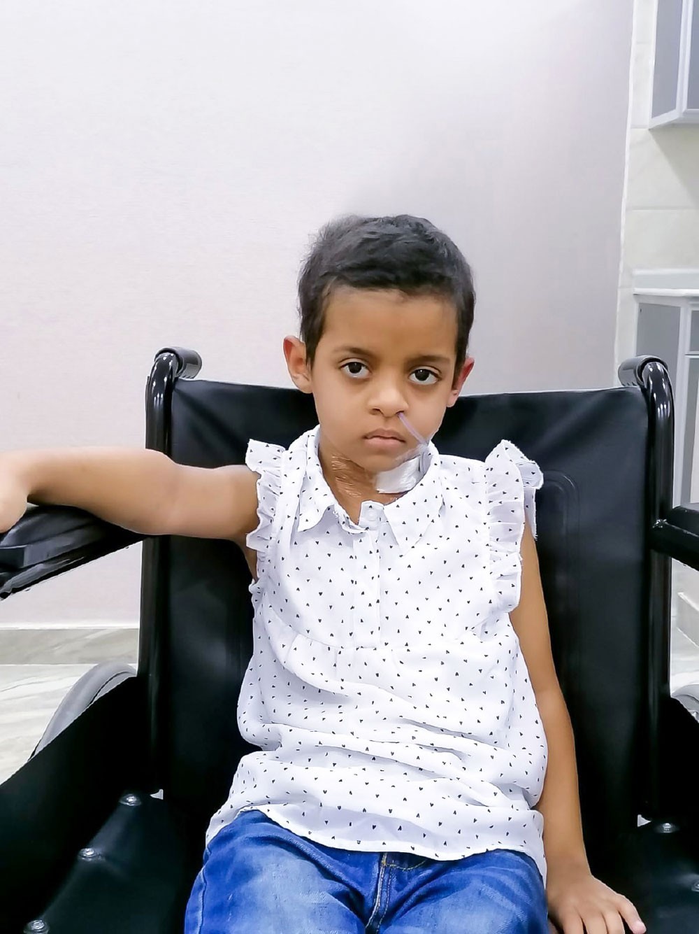 “حمد الجامعي” ينجح في استئصال ورم كبير من مخ طفلة