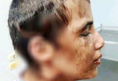 حروق وتعذيب وحشي.. طفلة الجيزة تهز الشارع المصري