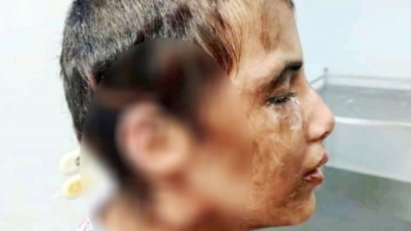 حروق وتعذيب وحشي.. طفلة الجيزة تهز الشارع المصري