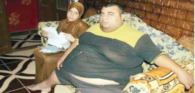 الرئيس المصري يأمر بعلاج شاب وزنه ربع طن